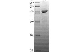 Validation with Western Blot (UBE2A Protein (Transcript Variant 1) (His tag))