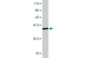 Western Blot detection against Immunogen (45. (DYDC2 antibody  (AA 1-177))