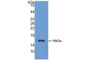 Detection of Recombinant MT1, Human using Polyclonal Antibody to Metallothionein 1 (MT1)