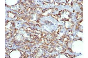 Immunohistochemistry (IHC) image for anti-Platelet/endothelial Cell Adhesion Molecule (PECAM1) antibody (ABIN6940285)