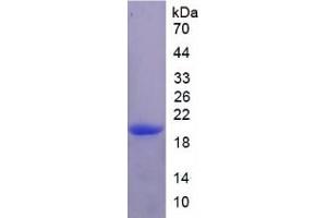 SDS-PAGE analysis of Rat IL17RE Protein. (IL17RE Protein)