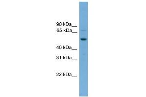 WB Suggested Anti-SKIL Antibody Titration: 0.