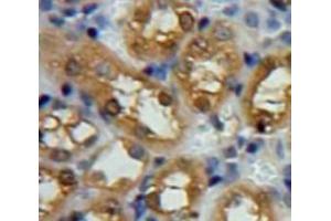 Used in DAB staining on fromalin fixed paraffin-embedded Kidney tissue (SNCG antibody  (AA 1-115))