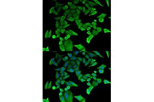 Immunofluorescence analysis of HeLa cells using TPT1 antibody. (TPT1 antibody)