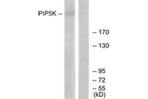 Western Blotting (WB) image for anti-phosphoinositide Kinase, FYVE Finger Containing (PIKFYVE) (AA 71-120) antibody (ABIN2889821) (PIKFYVE antibody  (AA 71-120))