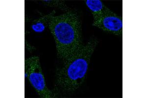 Immunofluorescent staining of human cell line Hep G2 with TANK polyclonal antibody  shows positivity in cytoplasm.