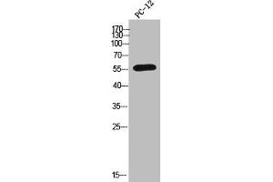 Western Blot analysis of PC-12 cells using CYP2A6 Polyclonal Antibody (CYP2A6 antibody  (N-Term))