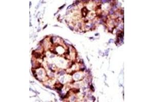 Image no. 2 for anti-Tumor Susceptibility Gene 101 (TSG101) (N-Term) antibody (ABIN357572) (TSG101 antibody  (N-Term))