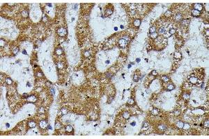 Immunohistochemistry of paraffin-embedded Human liver using APOC3 Polyclonal Antibody at dilution of 1:100 (40x lens). (APOC3 antibody)