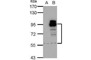 WB Image Sample (30 ug of whole cell lysate) A: A431 B: HeLa 7. (PDE4D antibody  (C-Term))