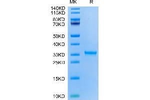 SARS-CoV-2 3CLpro (H172Y) on Tris-Bis PAGE under reduced condition. (SARS-Coronavirus Nonstructural Protein 8 (SARS-CoV NSP8) (H172Y) Protein)