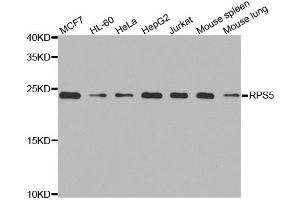 Western blot analysis of extracts of various cell lines, using RPS5 antibody. (RPS5 antibody)