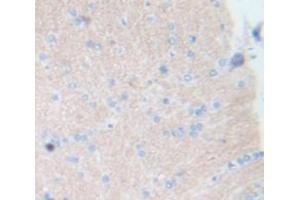 Immunohistochemistry (IHC) image for anti-Integrin alpha 1 (ITGA1) (AA 119-355) antibody (ABIN1980429)