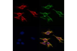ABIN6265363 and ABIN6268863 staining HepG2 by IF/ICC. (SUCNR1 antibody  (Internal Region))