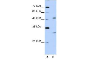 WBSCR1 antibody used at 2. (EIF4H antibody  (Middle Region))