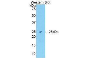 Western Blotting (WB) image for anti-Fibronectin (AA 355-558) antibody (ABIN1078037)