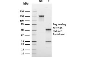 SDS-PAGE Analysis Purified C1QB Mouse Monoclonal Antibody (C1QB/2965). (C1QB antibody  (AA 41-188))