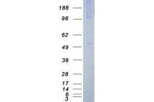 Western Blotting (WB) image for Janus Kinase 3 (JAK3) protein (Myc-DYKDDDDK Tag) (ABIN2734729)