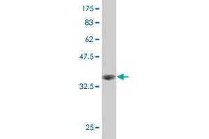 Western Blot detection against Immunogen (36. (LIM Domain Kinase 1 antibody  (AA 548-647))