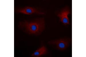 Immunofluorescent analysis of PAK1 staining in HEK293T cells. (PAK1 antibody  (Center))