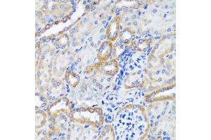 Immunohistochemistry of paraffin-embedded mouse kidney using ERK1 / ERK2 antibody (ABIN7268619) at dilution of 1:200 (40x lens). (ERK1 antibody  (AA 200-300))