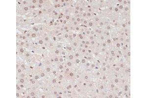 Immunohistochemistry of paraffin-embedded Rat liver using Phospho-STAT1(S727) Polyclonal Antibody at dilution of 1:100 (40x lens). (STAT1 antibody  (pSer727))