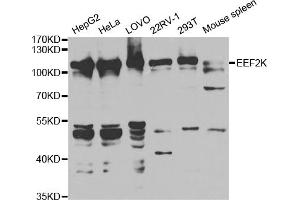 Western blot analysis of extracts of various cell lines, using EEF2K antibody. (EEF2K antibody)
