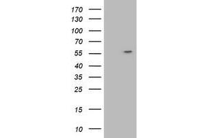 HEK293T cells were transfected with the pCMV6-ENTRY control (Left lane) or pCMV6-ENTRY ATP6V1B1 (Right lane) cDNA for 48 hrs and lysed. (ATP6V1B1 antibody)