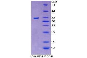 SDS-PAGE (SDS) image for Androgen Receptor (AR) (AA 15-246) protein (His tag,SUMO Tag) (ABIN1169851) (Androgen Receptor Protein (AR) (AA 15-246) (His tag,SUMO Tag))