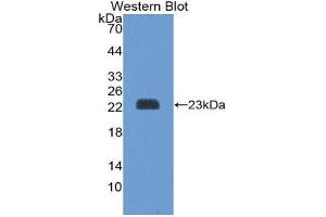 Western Blotting (WB) image for anti-Peroxiredoxin 1 (PRDX1) (AA 1-199) antibody (ABIN1175811) (Peroxiredoxin 1 antibody  (AA 1-199))
