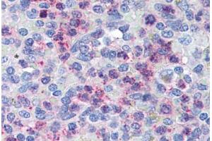 Human Spleen (formalin-fixed, paraffin-embedded) stained with CXCR4 antibody ABIN305765 at 5 ug/ml followed by biotinylated goat anti-rabbit IgG secondary antibody ABIN481713, alkaline phosphatase-streptavidin and chromogen. (CXCR4 antibody  (AA 182-196))