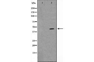 Western blot analysis of p38 MAPK expression in 293 whole cell lysates,The lane on the left is treated with the antigen-specific peptide. (MAPK14 antibody)