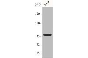 Western Blot analysis of HeLa cells using Catenin-α E/N Polyclonal Antibody (CTNNA2 antibody  (C-Term))
