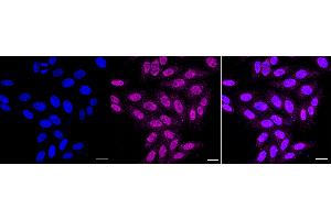 Immunocytochemical staining of HepG2 cells with Histone H2B (formyl K108) antibody (ABIN7798947), 1:1,000). (Recombinant Histone H2B antibody  (H2BK108fo))