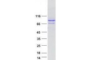 Validation with Western Blot (SPG20 Protein (Transcript Variant 3) (Myc-DYKDDDDK Tag))