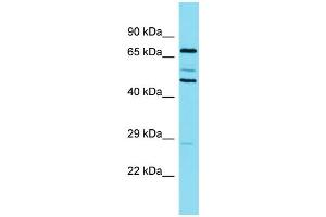 Western Blotting (WB) image for anti-Cortactin (CTTN) (N-Term) antibody (ABIN2774002)