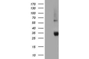 HEK293T cells were transfected with the pCMV6-ENTRY control (Left lane) or pCMV6-ENTRY NPTN (Right lane) cDNA for 48 hrs and lysed. (NPTN antibody)