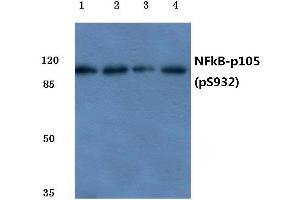 Western blot (WB) analysis of p-NFkB-p105 antibody at 1/500 dilution (NFKB1 antibody  (pSer932))