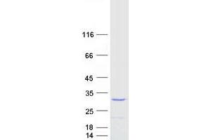 Validation with Western Blot