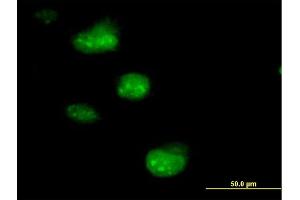 Immunofluorescence of purified MaxPab antibody to SSNA1 on HeLa cell.