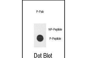 Dot blot analysis of Phospho-hE2F1- Pab (ABIN650836 and ABIN2839802) on nitrocellulose membrane. (E2F1 antibody  (His357))