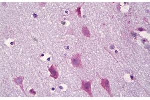 Anti-KCNIP3 / CSEN antibody IHC staining of human brain, cortex neurons. (DREAM antibody  (AA 29-78))