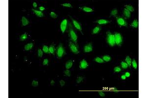 Immunofluorescence of monoclonal antibody to HDAC5 on HeLa cell. (HDAC5 antibody  (AA 330-429))