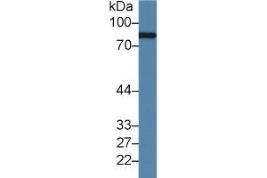 Detection of CFB in Rat Serum using Polyclonal Antibody to Complement Factor B (CFB) (Complement Factor B antibody  (AA 269-382))