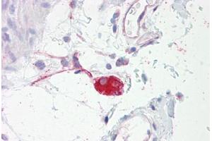 Anti-ADRA2A antibody IHC staining of human colon, submucosal plexus.
