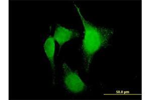 Immunofluorescence of purified MaxPab antibody to PTGS2 on HeLa cell.