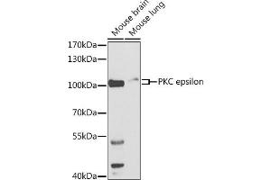 Western blot analysis of extracts of various cell lines, using PKC epsilon antibody (ABIN3022941, ABIN3022942, ABIN3022943 and ABIN6219308) at 1:500 dilution. (PKC epsilon antibody  (AA 488-737))