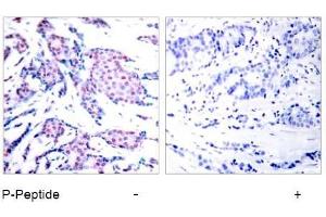 Image no. 1 for anti-Jun Proto-Oncogene (JUN) (pThr93) antibody (ABIN196648) (C-JUN antibody  (pThr93))