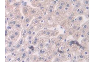 DAB staining on IHC-P; Samples: Mouse Liver Tissue
