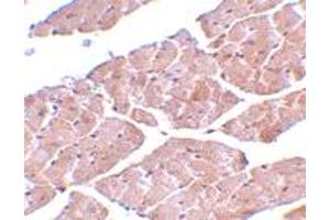 Immunohistochemistry of TRPC3 in mouse heart tissue with TRPC3 polyclonal antibody  at 2 ug/mL . (TRPC3 antibody  (C-Term))